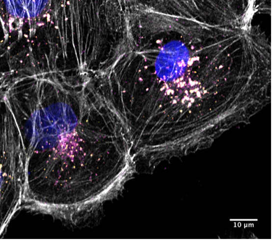 Human Kidney 2 cell showing actin assemblies