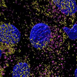 3D reconstruction of a mouse proximal tubule cell with OCRL deficiency (left) and alpelisib treatment (right)