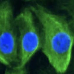 Human milk cells grown in culture. Image: Alecia-Jane Twigger