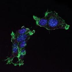 Normal and genetically engineered pancreatic cancer cells