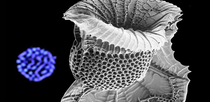 Dinoflagellates compact DNA without histones