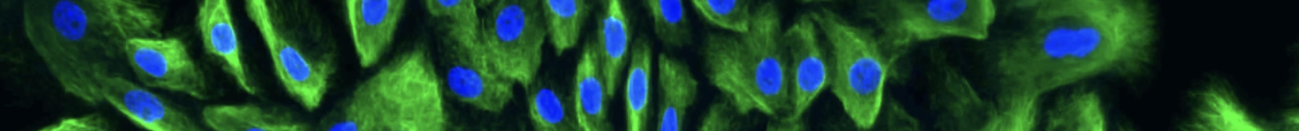 Human milk cells grown in culture. Image: Alecia-Jane Twigger