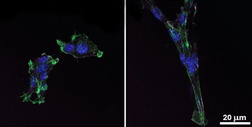 Normal and genetically engineered pancreatic cancer cells